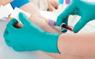 Анализ крови на ПСА и расшифровка показателей уровня онкомаркера