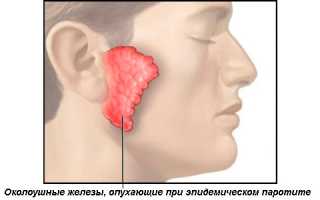 Эпидемический паротит: может ли мужчина, переболевший свинкой, иметь детей?