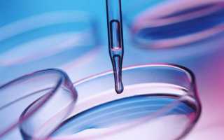 Что представляет собой мазок на флору у мужчин: расшифровка