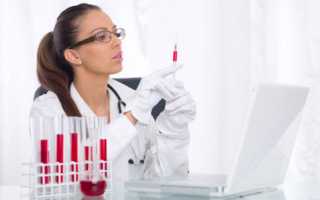 Особенности анализа крови на ПСА