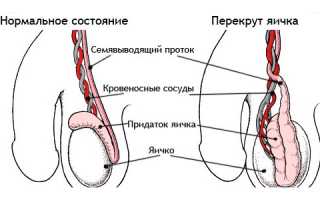 По какой причине опухло левое яичко и болит
