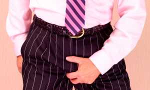 Паховая эпидермофития у мужчин: симптомы и лечение заболевания