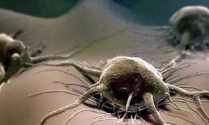 Трихомониаз у мужчин: диагностика и лечение