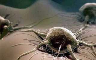 Трихомониаз у мужчин: диагностика и лечение