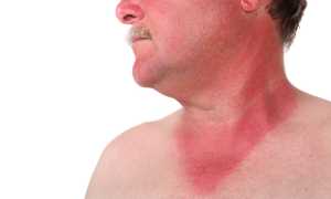 Как выявляется и лечится рак предстательной железы?