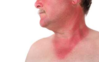 Как выявляется и лечится рак предстательной железы?