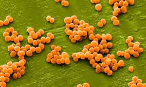 Как проявляется стафилококк у мужчин?