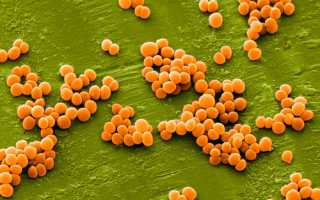 Как проявляется стафилококк у мужчин?