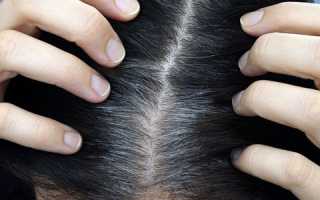 Способы избавления от седины в домашних условиях