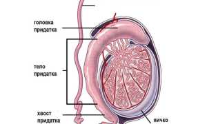 Как проявляется острый орхоэпидидимит?