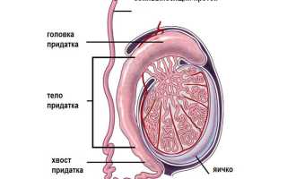 Как проявляется острый орхоэпидидимит?