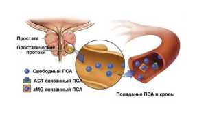 Тестирование на простатспецифический антиген (ПСА)