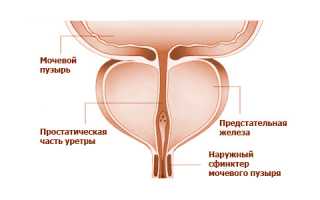 Хронический конгестивный простатит и его лечение