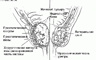 Гипертрофия предстательной железы у мужчин