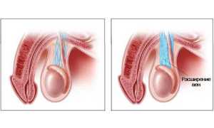 Почему из члена может идти кровь?