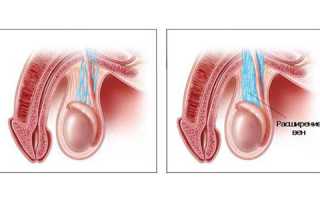 Почему из члена может идти кровь?