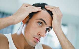 К какому врачу нужно идти если выпадают волосы?