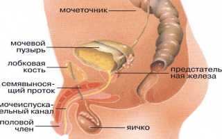 Лечние болезней мочевого пузыря у мужчин