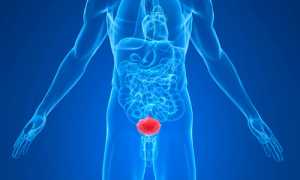 Симптомы и лечение везикулита