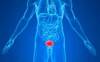 Симптомы и лечение везикулита