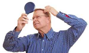 Эффективные средства от выпадения волос у мужчин