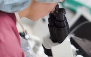 Спермограмма: как готовиться к сбору эякулята?