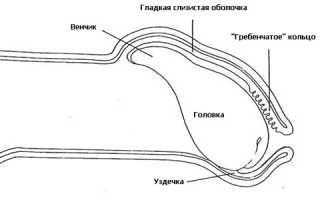 Почему может болеть уздечка крайней плоти