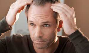 Основные причины, почему стали выпадать волосы?