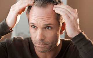 Основные причины, почему стали выпадать волосы?