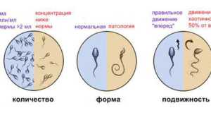 Критерии анализа спермы: малоподвижные сперматозоиды