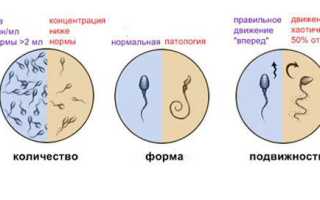 Критерии анализа спермы: малоподвижные сперматозоиды