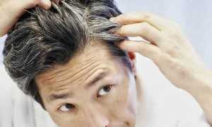 Если рано седеют волосы у мужчин: почему это происходит?