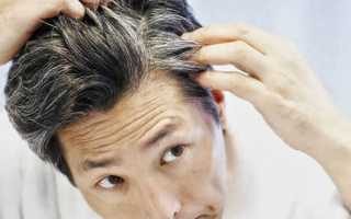 Если рано седеют волосы у мужчин: почему это происходит?