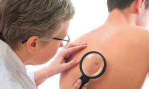 От чего появляются пигментные пятна у мужчин на теле?