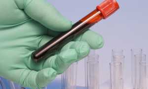 Чем опасна 1 отрицательная группа крови у мужчин