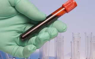 Чем опасна 1 отрицательная группа крови у мужчин