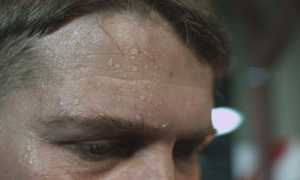 Причины пота на лбу у взрослых людей