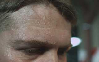 Причины пота на лбу у взрослых людей