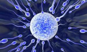 Чем опасна для мужчины нормозооспермия с агрегацией