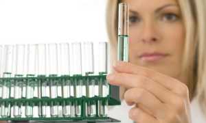 Как сдать и проверить спермограмму