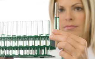 Как сдать и проверить спермограмму