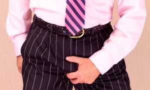 Возникновение зуда в паху у мужчин