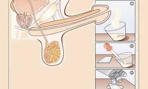 Какое значение для мужчины имеет подвижность спермиев?