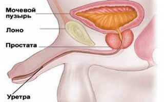 Уретрит у мужчин: симптомы, особенности, лечение