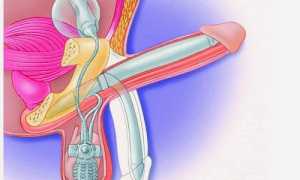 Как и зачем проводится фаллопластика?