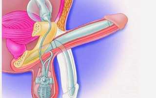 Как и зачем проводится фаллопластика?