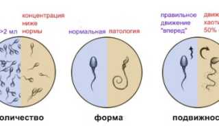 Почему бывают сгустки в сперме у мужчин
