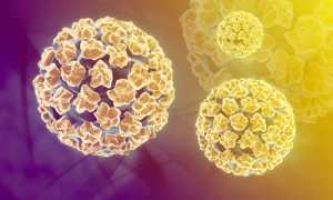 Клиническая картина и лечение ВПЧ у мужчин