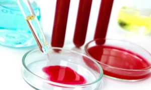 Норма мочевины крови у мужчин и отклонение от нее