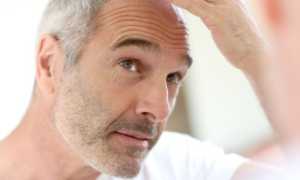 Если волосы выпадают клочьями, что делать и как решить проблему?